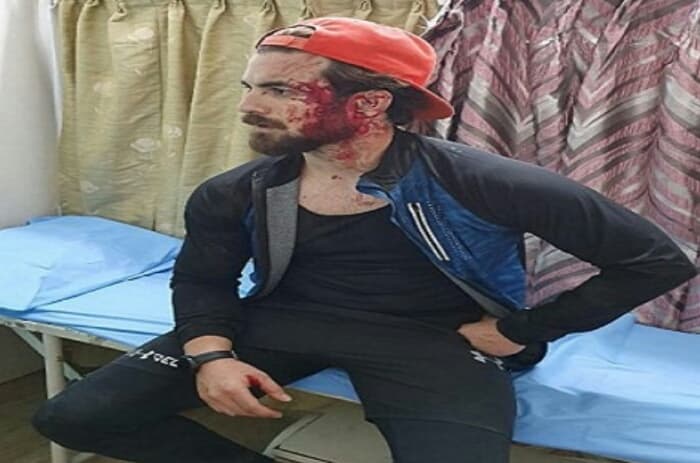 Kashmiri engineering student assaulted in Bengaluru